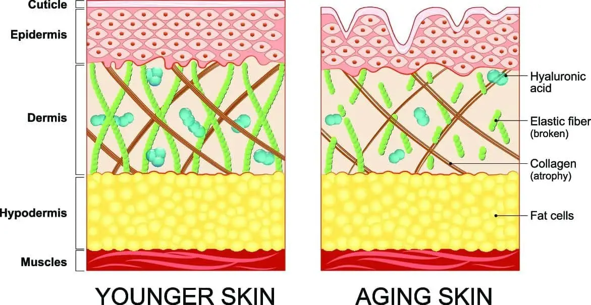 Signs of Collagen Loss in the Face